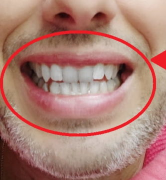 dientes blancos