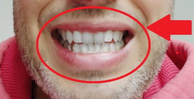 dientes blancos